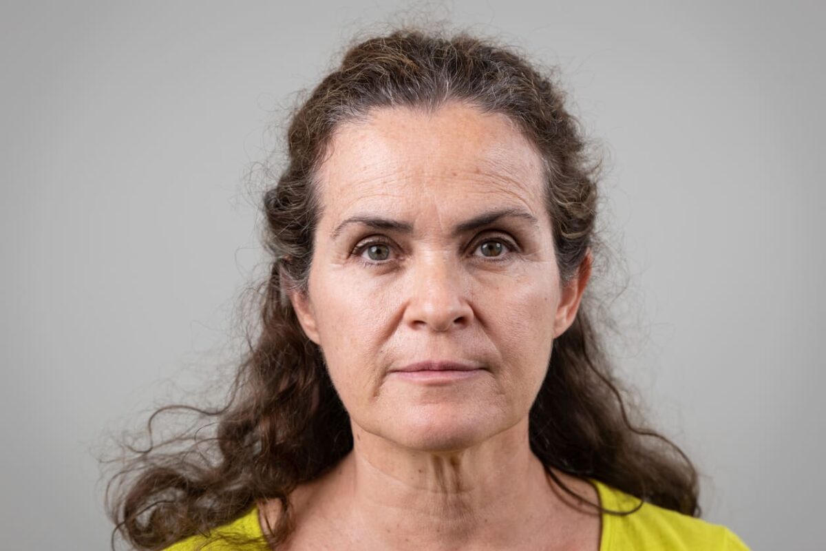 Estrogen face