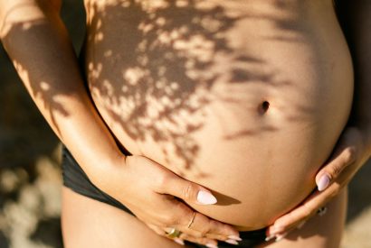 Thumbnail for How to Prevent Stretch Marks During Pregnancy, According to Experts